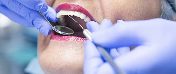 Best Broken or Chipped Tooth Repair in De Smet, SD